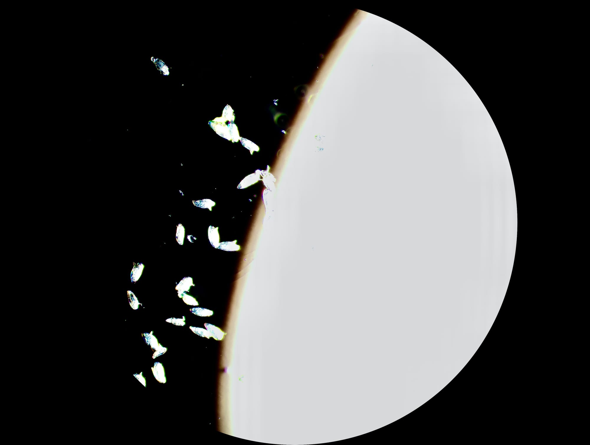 Schistosome eggs glow white against a black background at the edge of a bright circular field of view