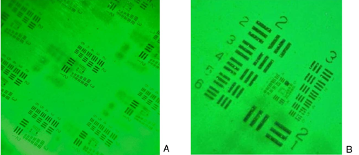 Two green-tinted photographs of a USAF resolution test target captured through a smartphone slit lamp, labelled A and B, showing finely resolved bar patterns